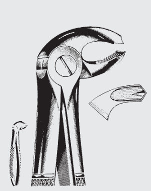 Pinzas de extracción Engl.fig.23